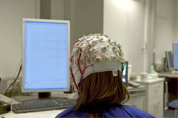 Imagem ilustrativa de Neuromodulação